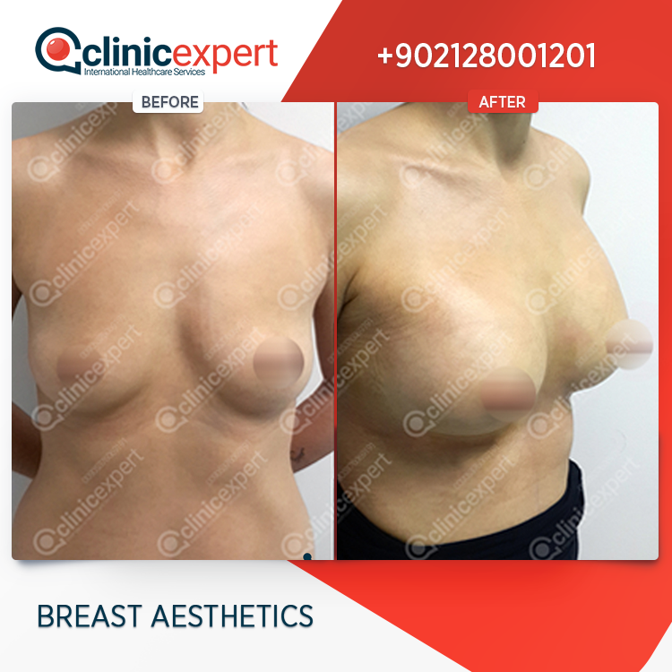 Clinic Expert Aesthetic