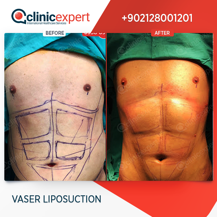 Clinic Expert Aesthetic