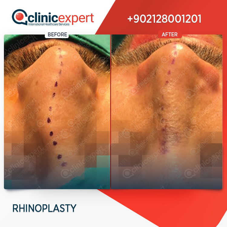 Clinic Expert Aesthetic