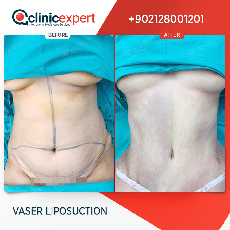 Clinic Expert Aesthetic