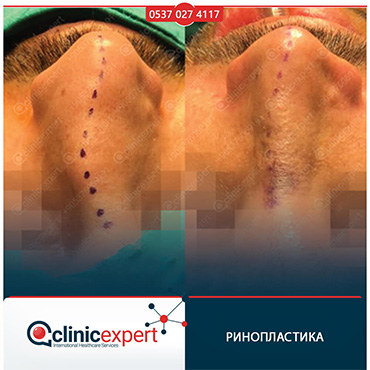 Clinic Expert Aesthetic