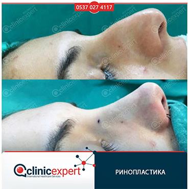 Clinic Expert Aesthetic