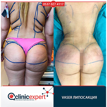 Clinic Expert Aesthetic