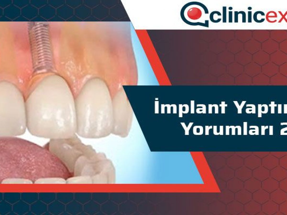 implant yaptiranlarin yorumlari 2020 clinicexpert estetik merkezi