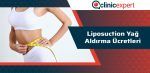 liposuction-yag-aldirma-ucretleri-cln-min