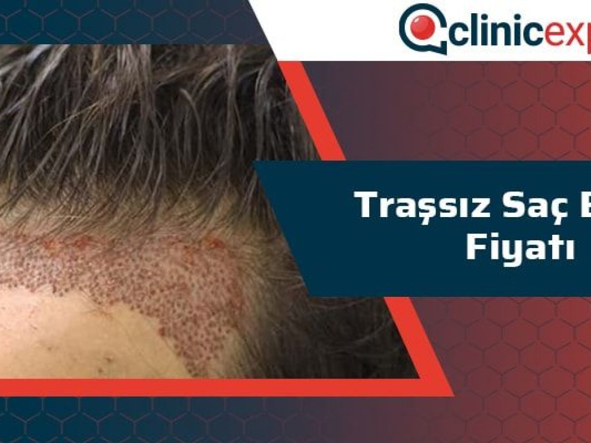 Tirassiz Sac Ekimi Fiyati Clinicexpert Uluslararasi Saglik Hizmetleri