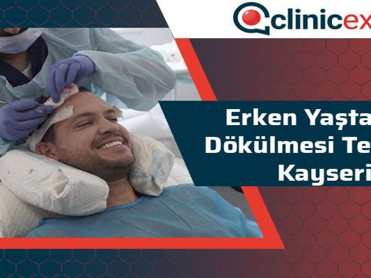 erken yasta sac dokulmesi tedavisi kayseri clinicexpert com