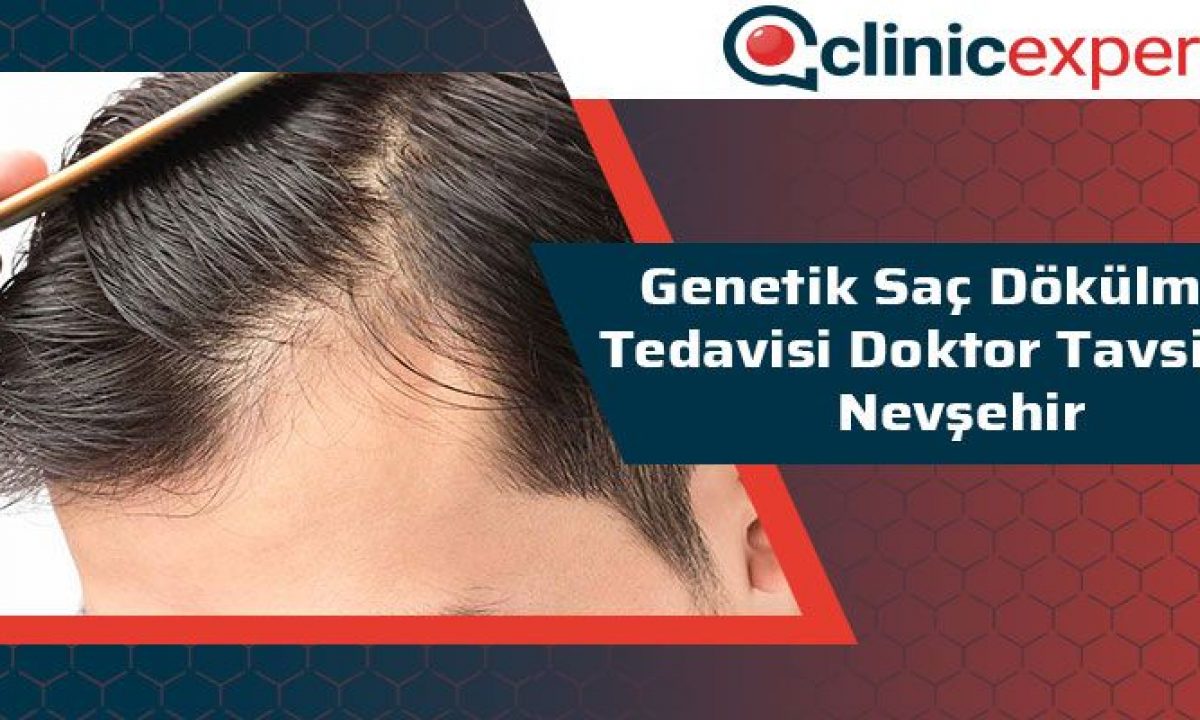 Genetik Sac Dokulmesi Tedavisi Doktor Tavsiye Nevsehir