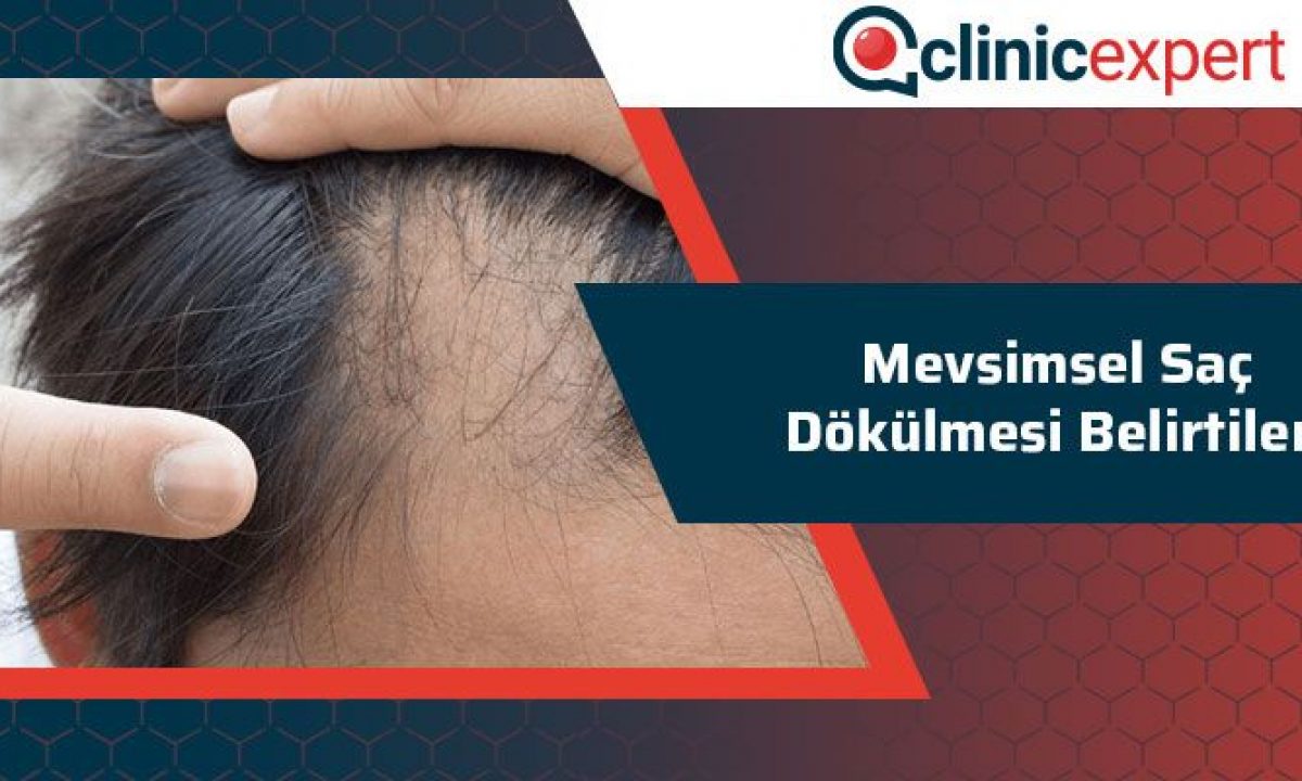 Mevsimsel Sac Dokulmesi Belirtileri Clinicexpert Com