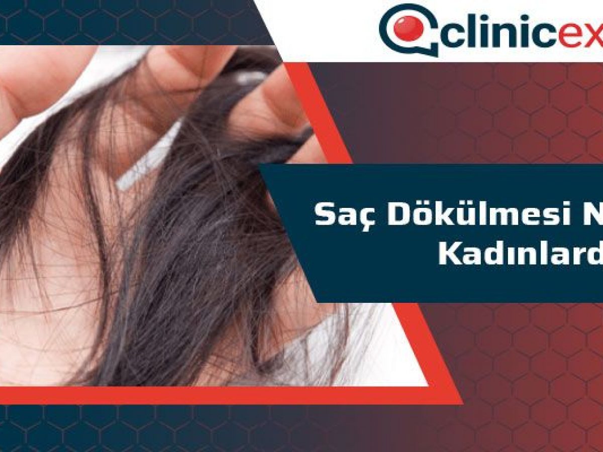 Sac Dokulmesi Nedenleri Kadinlarda Clinicexpert Sac Ekim Merkezi