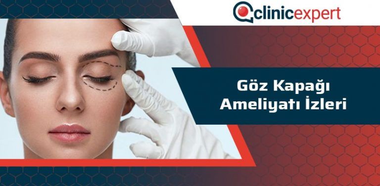 Göz Kapağı Ameliyatı İzleri | ClinicExpert - Estetik Merkezi