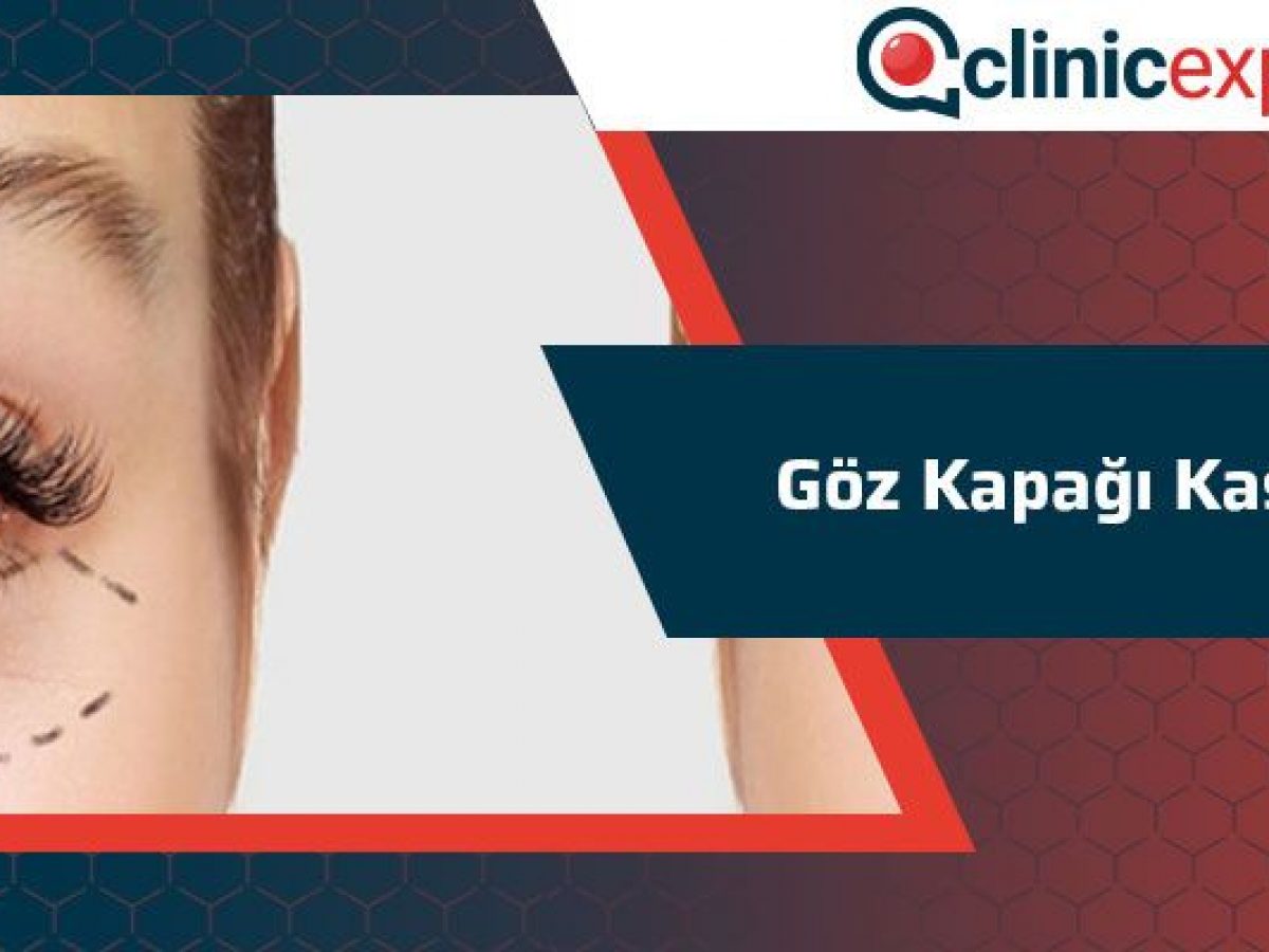 Goz Kapagi Kasilmasi Clinicexpert Uluslararasi Saglik Hizmetleri