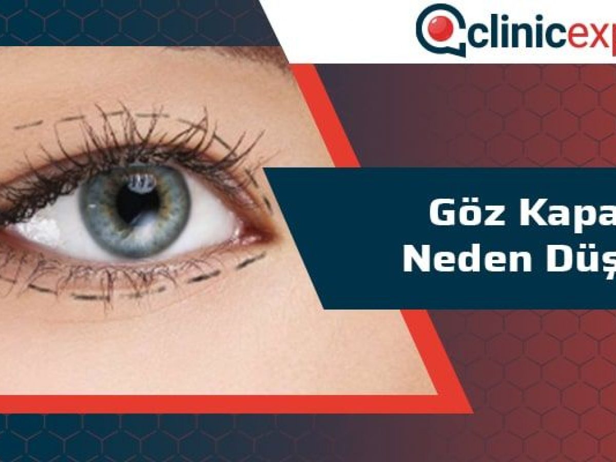 Goz Kapagi Neden Duser Clinicexpert Estetik Merkezi