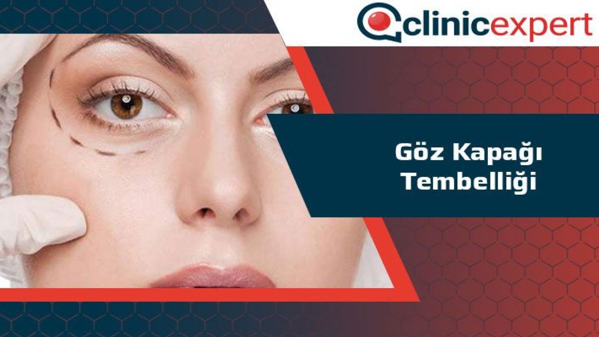 goz kapagi tembelligi clinicexpert uluslararasi saglik hizmetleri