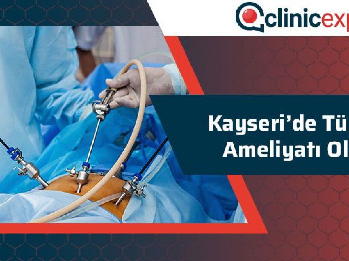 kayseri de tup mide ameliyati olanlar