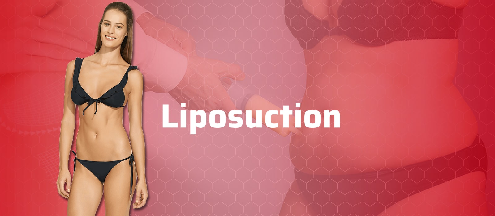 Liposuction