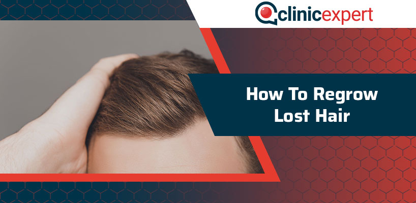 How To Regrow Lost Hair?