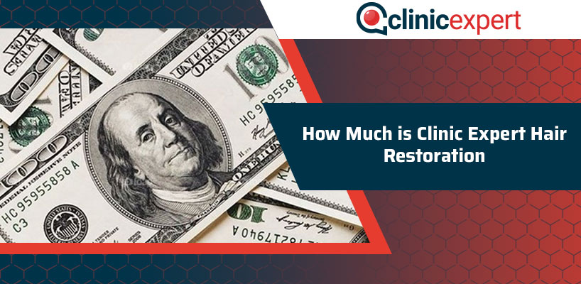How Much Is ClinicExpert Hair Restoration