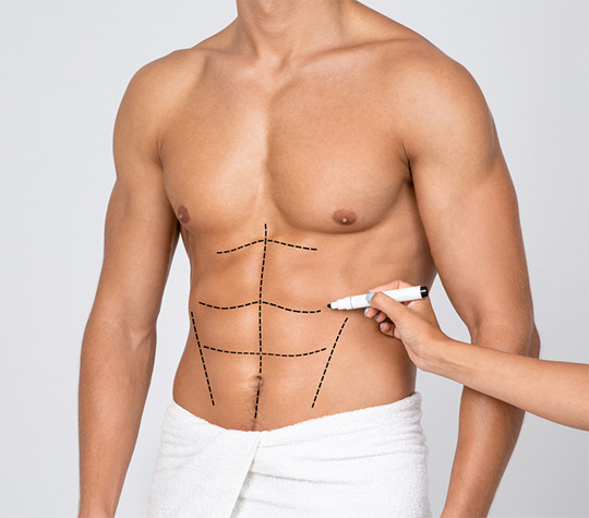 vaser-liposuction