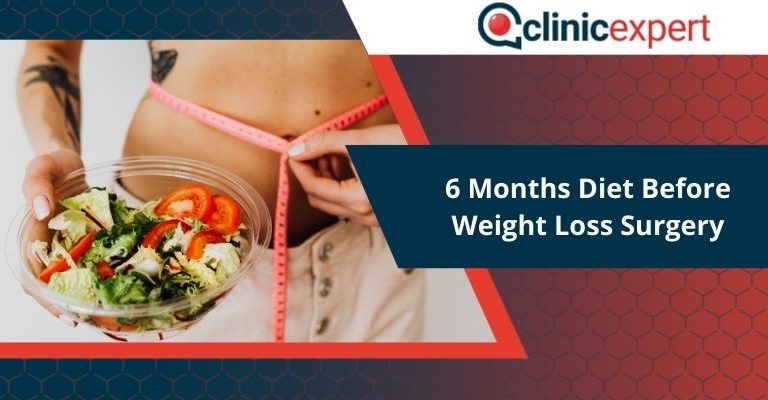6 Months Diet Before Weight Loss Surgery