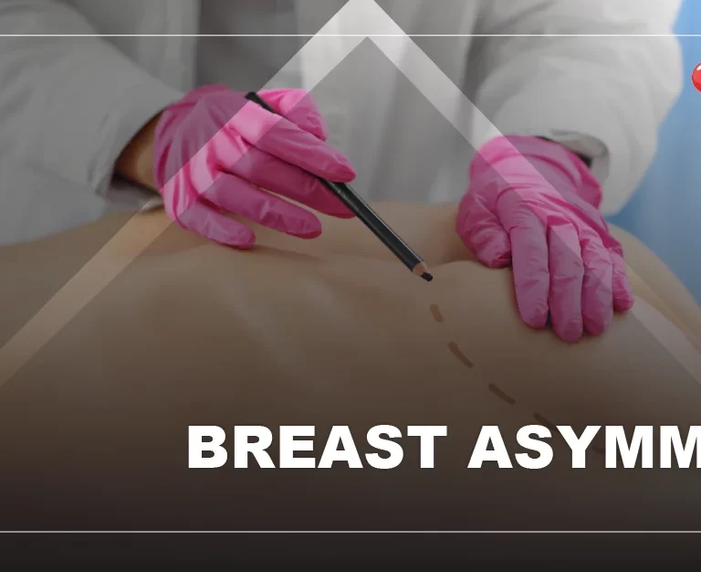 asymmetry in breast